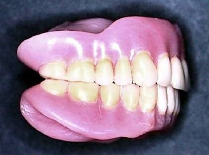 Pink Acid Queen Dentures Iva SC 29655